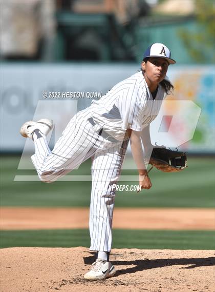 Thumbnail 2 in Segerstrom vs. Anaheim photogallery.