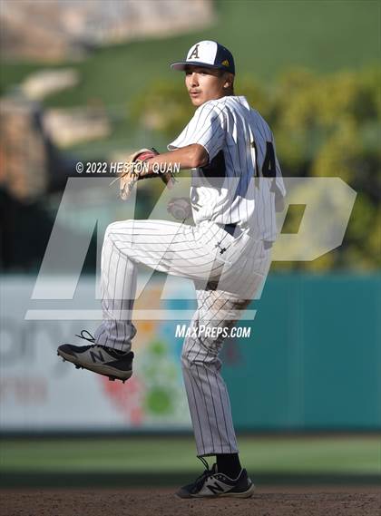 Thumbnail 1 in Segerstrom vs. Anaheim photogallery.