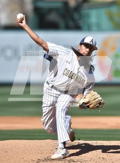 Thumbnail 1 in Segerstrom vs. Anaheim photogallery.