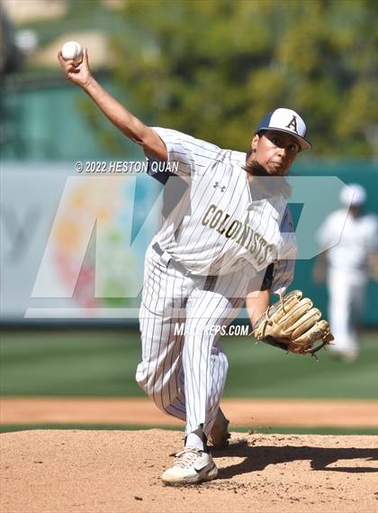 Thumbnail 2 in Segerstrom vs. Anaheim photogallery.