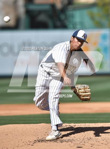 Thumbnail 3 in Segerstrom vs. Anaheim photogallery.