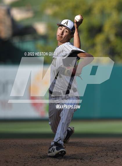Thumbnail 1 in Segerstrom vs. Anaheim photogallery.