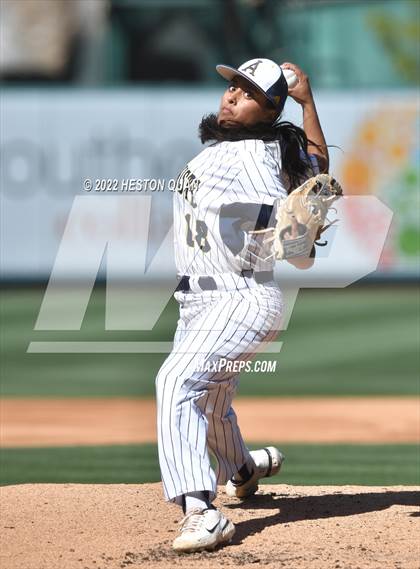Thumbnail 3 in Segerstrom vs. Anaheim photogallery.