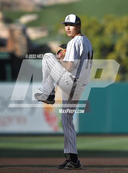 Thumbnail 3 in Segerstrom vs. Anaheim photogallery.