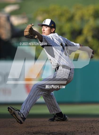 Thumbnail 3 in Segerstrom vs. Anaheim photogallery.