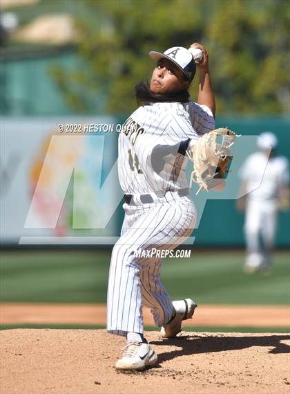 Thumbnail 1 in Segerstrom vs. Anaheim photogallery.