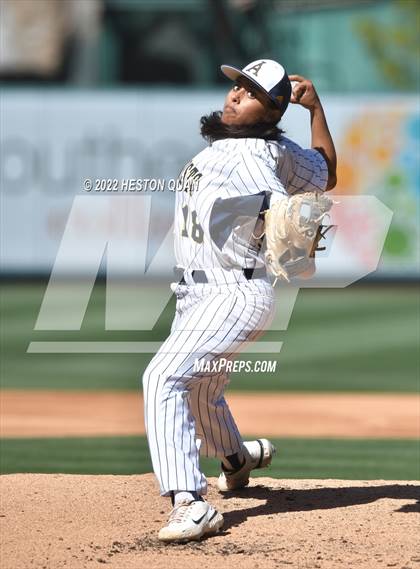 Thumbnail 3 in Segerstrom vs. Anaheim photogallery.