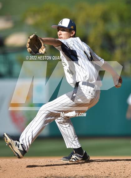 Thumbnail 2 in Segerstrom vs. Anaheim photogallery.