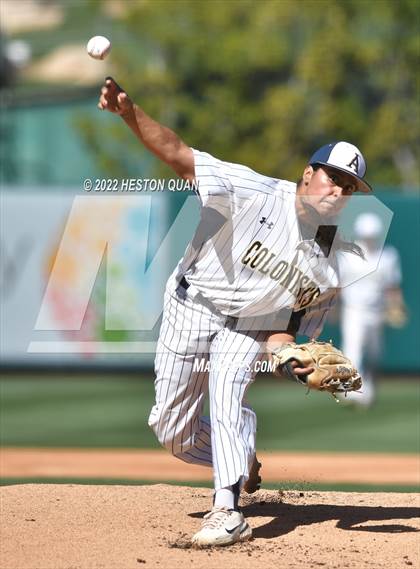 Thumbnail 3 in Segerstrom vs. Anaheim photogallery.
