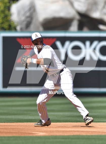 Thumbnail 1 in Segerstrom vs. Anaheim photogallery.
