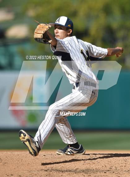 Thumbnail 1 in Segerstrom vs. Anaheim photogallery.