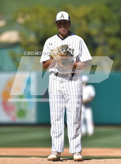 Thumbnail 3 in Segerstrom vs. Anaheim photogallery.