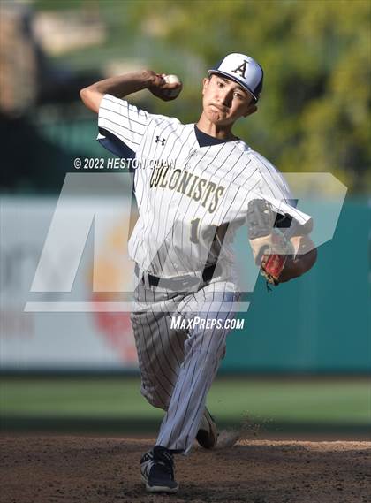 Thumbnail 2 in Segerstrom vs. Anaheim photogallery.