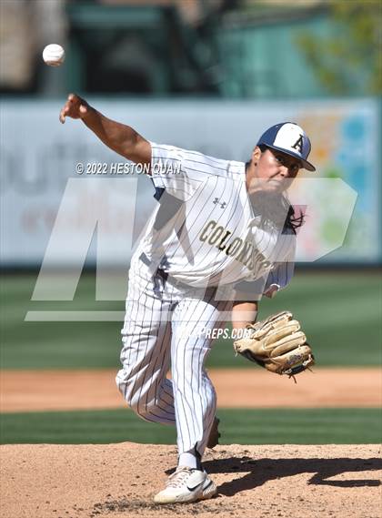 Thumbnail 2 in Segerstrom vs. Anaheim photogallery.