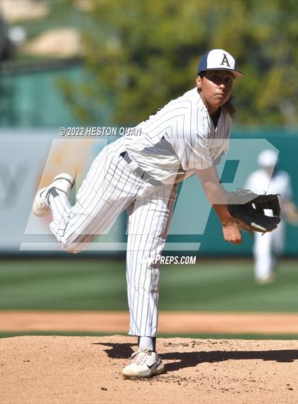 Thumbnail 3 in Segerstrom vs. Anaheim photogallery.