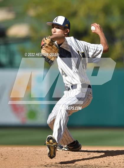 Thumbnail 1 in Segerstrom vs. Anaheim photogallery.