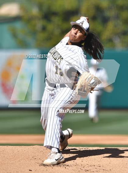 Thumbnail 2 in Segerstrom vs. Anaheim photogallery.