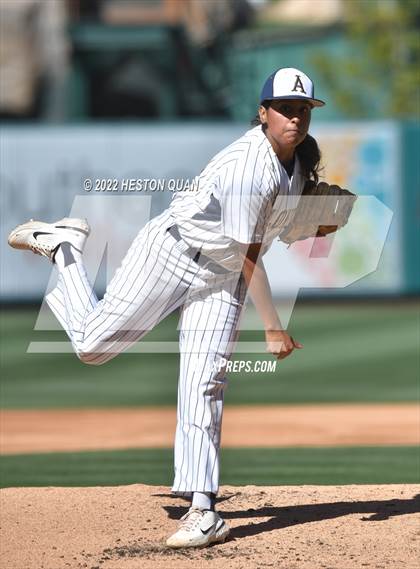 Thumbnail 3 in Segerstrom vs. Anaheim photogallery.