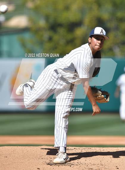 Thumbnail 1 in Segerstrom vs. Anaheim photogallery.
