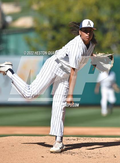 Thumbnail 1 in Segerstrom vs. Anaheim photogallery.