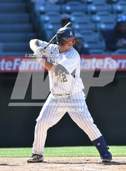Thumbnail 1 in Segerstrom vs. Anaheim photogallery.