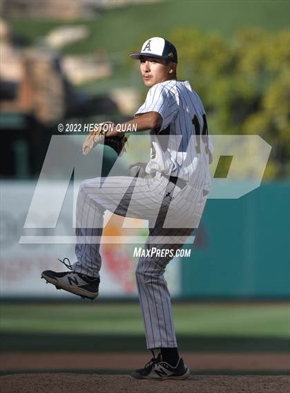 Thumbnail 1 in Segerstrom vs. Anaheim photogallery.