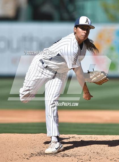 Thumbnail 3 in Segerstrom vs. Anaheim photogallery.