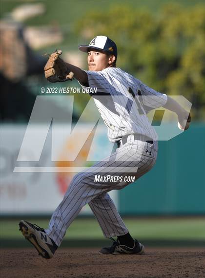 Thumbnail 1 in Segerstrom vs. Anaheim photogallery.