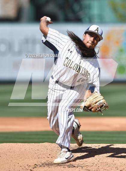 Thumbnail 1 in Segerstrom vs. Anaheim photogallery.