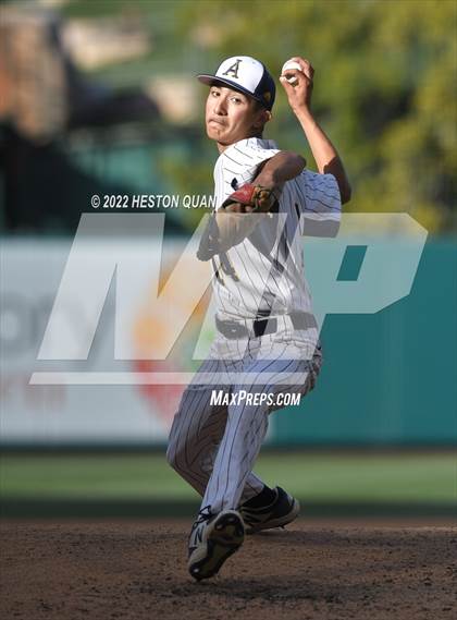 Thumbnail 1 in Segerstrom vs. Anaheim photogallery.
