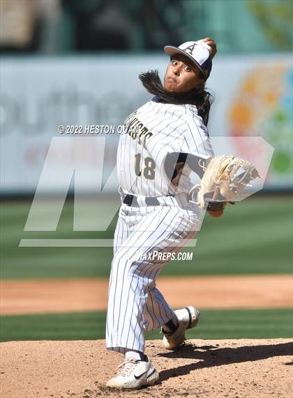 Thumbnail 1 in Segerstrom vs. Anaheim photogallery.