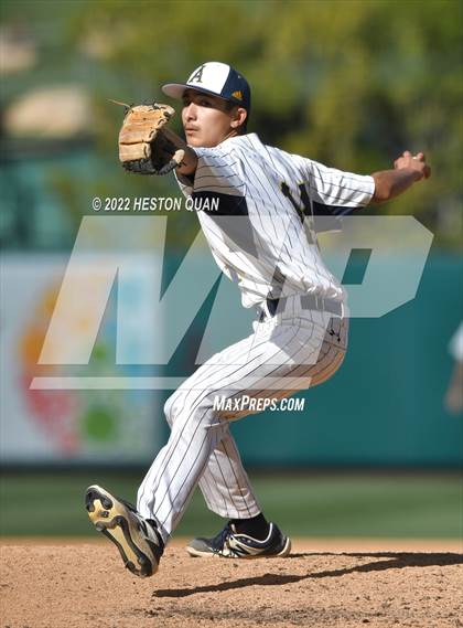 Thumbnail 1 in Segerstrom vs. Anaheim photogallery.