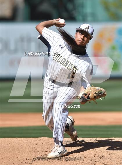 Thumbnail 2 in Segerstrom vs. Anaheim photogallery.