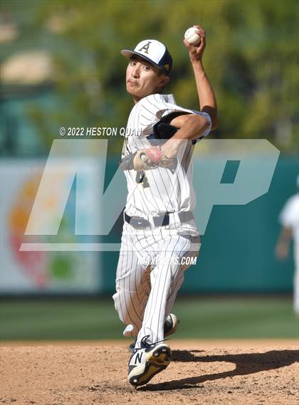 Thumbnail 1 in Segerstrom vs. Anaheim photogallery.