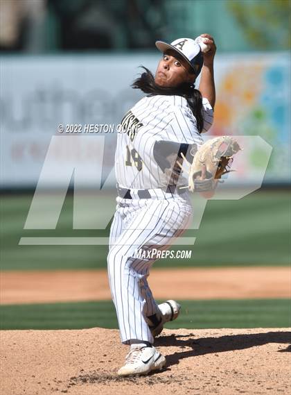 Thumbnail 1 in Segerstrom vs. Anaheim photogallery.