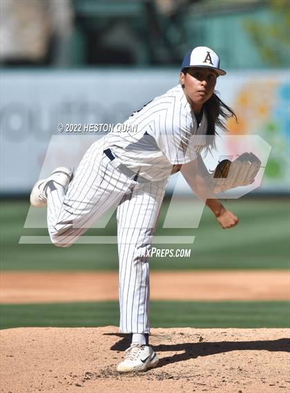 Thumbnail 2 in Segerstrom vs. Anaheim photogallery.