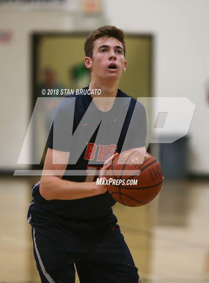 Thumbnail 3 in Beckman vs. Irvine  photogallery.