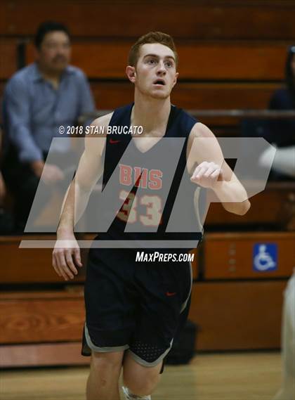 Thumbnail 2 in Beckman vs. Irvine  photogallery.
