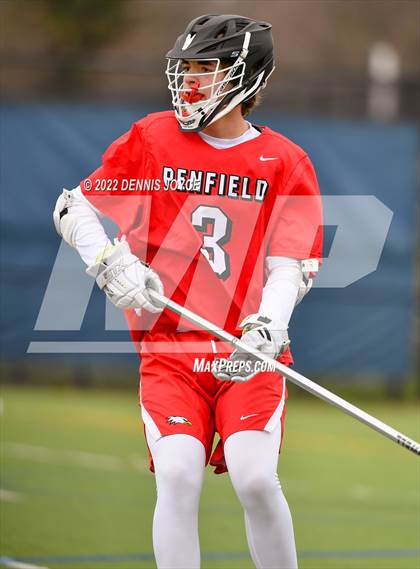 Thumbnail 2 in Penfield @ West Genesee photogallery.