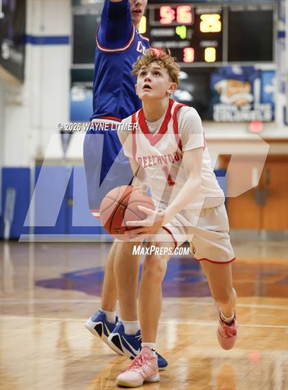 Thumbnail 2 in FR: Conner vs Beechwood photogallery.