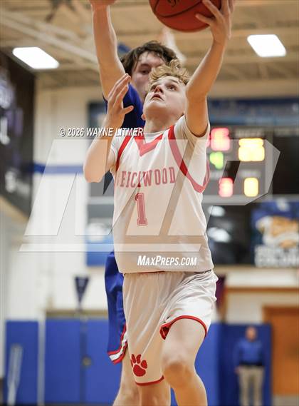Thumbnail 1 in FR: Conner vs Beechwood photogallery.