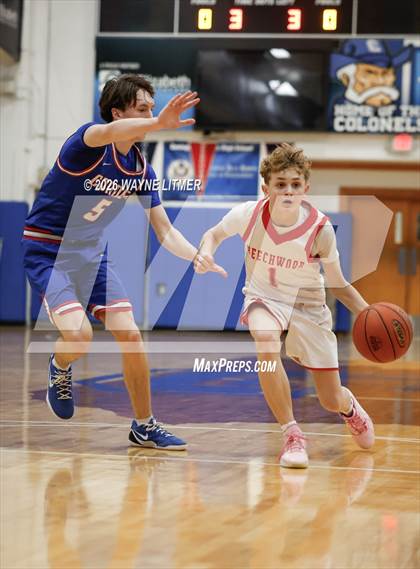 Thumbnail 1 in FR: Conner vs Beechwood photogallery.