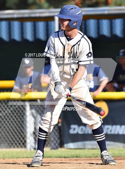 Thumbnail 2 in Los Osos @ Chino Hills photogallery.