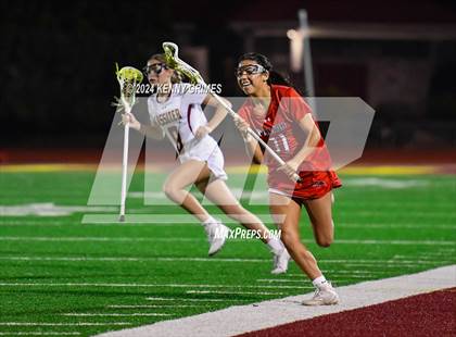 Thumbnail 2 in Milton vs Lassiter photogallery.