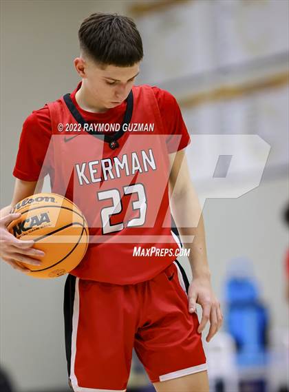 Thumbnail 1 in Buchanan vs. Kerman photogallery.
