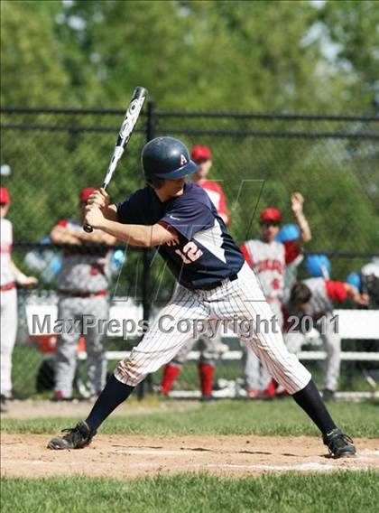 Thumbnail 2 in Conard @ Avon photogallery.
