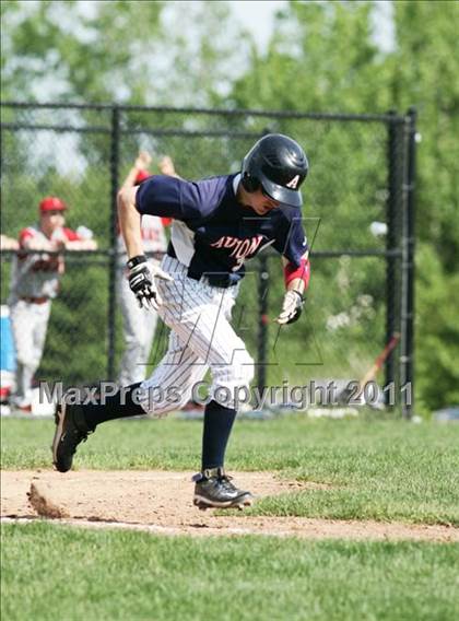 Thumbnail 3 in Conard @ Avon photogallery.