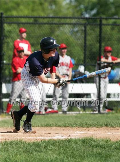 Thumbnail 1 in Conard @ Avon photogallery.