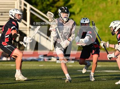 Thumbnail 2 in Foran @ Xavier photogallery.