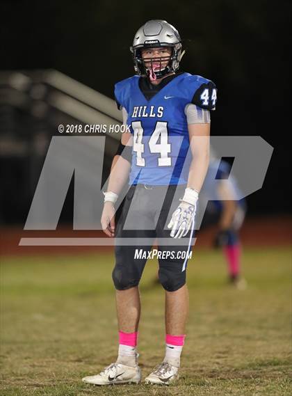 Thumbnail 3 in Casa Grande @ Catalina Foothills photogallery.